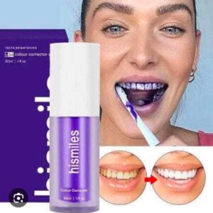 Hismile Teeth Whitening